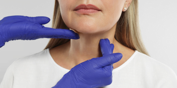 Hyperthyroidism