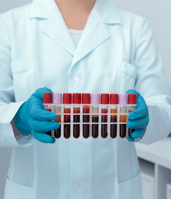 Blood tests